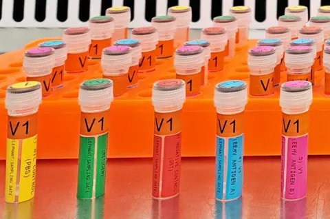 Falko Steinbach/University of Surrey A row of brightly coloured vials - labelled EEHV antigen - are lined up on a laboratory bench. This is one of the key ingredients in the newly developed vaccine that scientists hope will save elephants' lives